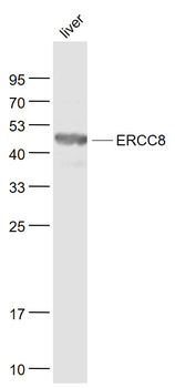 ERCC8 Rabbit Polyclonal Antibody