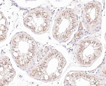 Phospho-ERK5 (Thr218 + Tyr220) Rabbit Polyclonal Antibody