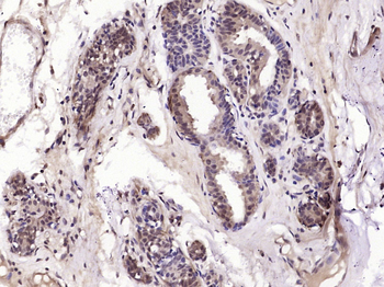 ESE1 Rabbit Polyclonal Antibody