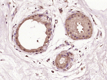 ESE1 Rabbit Polyclonal Antibody