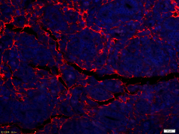 ADGRL4 Rabbit Polyclonal Antibody