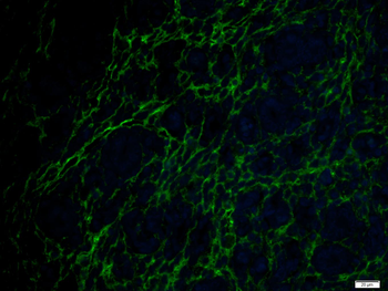 ADGRL4 Rabbit Polyclonal Antibody