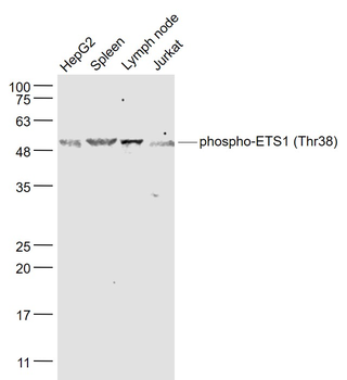 Phospho-ETS1 (Thr38) Rabbit Polyclonal Antibody