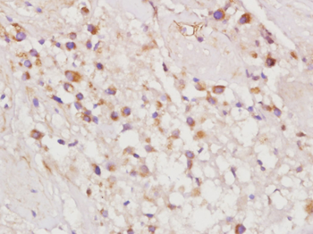 Phospho-Ezrin (Tyr146) Rabbit Polyclonal Antibody