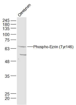 Phospho-Ezrin (Tyr146) Rabbit Polyclonal Antibody