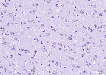 Factor VIII B chain Rabbit Polyclonal Antibody