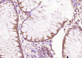 Factor VIII B chain Rabbit Polyclonal Antibody