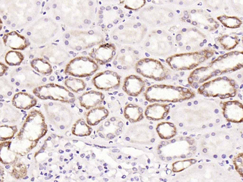 Factor VIII B chain Rabbit Polyclonal Antibody