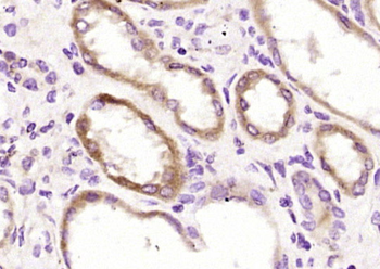 Factor VIII B chain Rabbit Polyclonal Antibody