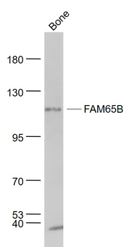 FAM65B Rabbit Polyclonal Antibody