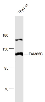 FAM65B Rabbit Polyclonal Antibody