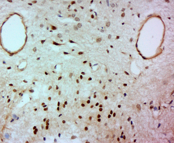 FAN1 Rabbit Polyclonal Antibody