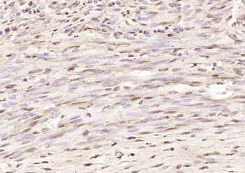 FANCA Rabbit Polyclonal Antibody