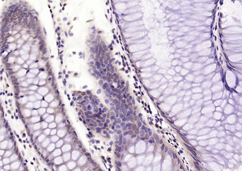 FANCC Rabbit Polyclonal Antibody