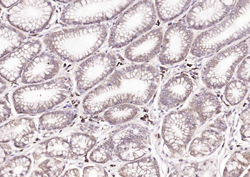 FBXO2 Rabbit Polyclonal Antibody