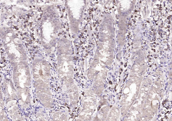 FBXO2 Rabbit Polyclonal Antibody