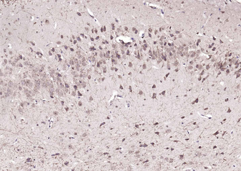 FBXO2 Rabbit Polyclonal Antibody