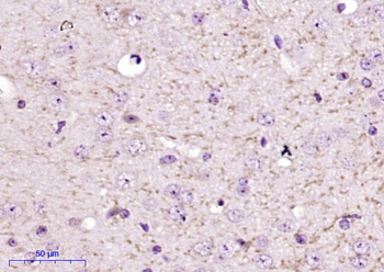 FBXO2 Rabbit Polyclonal Antibody
