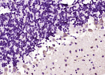 FBXO2 Rabbit Polyclonal Antibody