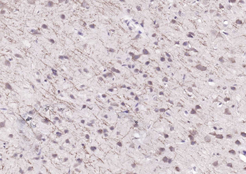 FBXO2 Rabbit Polyclonal Antibody
