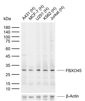 FBXO45 Rabbit Polyclonal Antibody