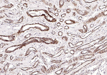 FDPS Rabbit Polyclonal Antibody
