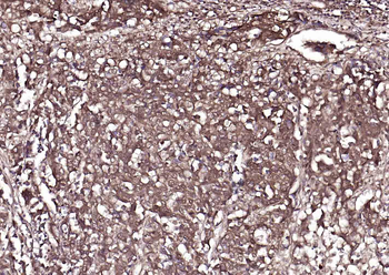 FDPS Rabbit Polyclonal Antibody