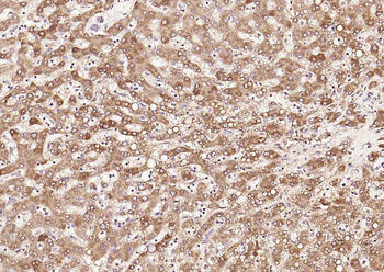 FDPS Rabbit Polyclonal Antibody