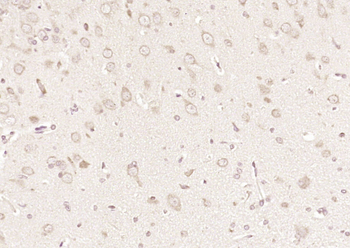 FDPS Rabbit Polyclonal Antibody