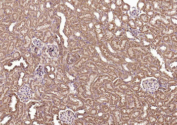 FDPS Rabbit Polyclonal Antibody