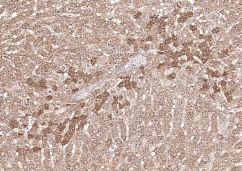 FDPS Rabbit Polyclonal Antibody