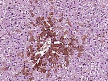 FENS1 Rabbit Polyclonal Antibody