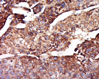 Ferritin Heavy Chain Rabbit Polyclonal Antibody