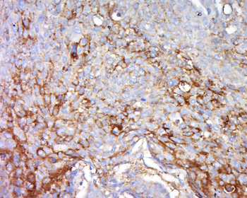 FGFBP2 Rabbit Polyclonal Antibody