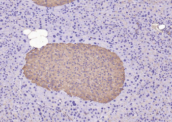 Phospho-FGFR1 (Tyr154) Rabbit Polyclonal Antibody