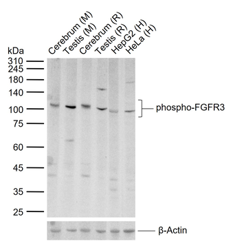Phospho-FGFR3 (Tyr724) Rabbit Polyclonal Antibody