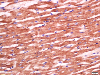 Phospho-FHOD1 (Thr1141) Rabbit Polyclonal Antibody