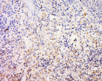 Phospho-FHOD1 (Thr1141) Rabbit Polyclonal Antibody