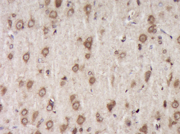 Fibromodulin Rabbit Polyclonal Antibody