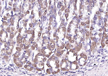 FLNC Rabbit Polyclonal Antibody