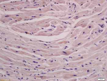 FLNC Rabbit Polyclonal Antibody