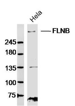 FLNB Rabbit Polyclonal Antibody