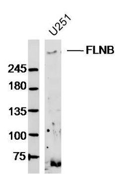 FLNB Rabbit Polyclonal Antibody