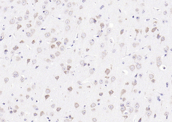 Phospho-FMRP (Ser500) Rabbit Polyclonal Antibody