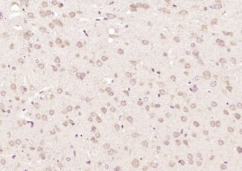 Phospho-FMRP (Ser500) Rabbit Polyclonal Antibody