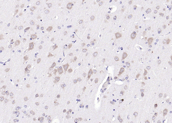 Phospho-FMRP (Ser500) Rabbit Polyclonal Antibody