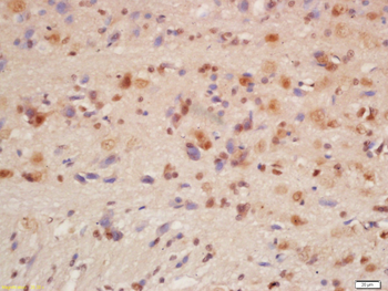 Phospho-FMRP (Ser500) Rabbit Polyclonal Antibody