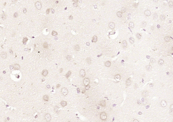 FOPNL Rabbit Polyclonal Antibody