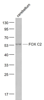FOX C2 Rabbit Polyclonal Antibody