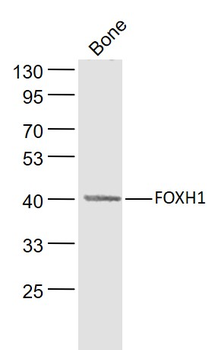 FOXH1 Rabbit Polyclonal Antibody
